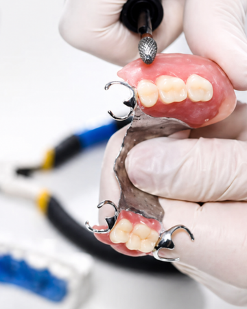 Laboratorio dental en Mataró fabricando prótesis esqueléticas. En la imagen se observa el pulido de la dentadura con manos con guantes.