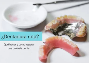 Iamngen de una dentadura rota, en un laboratorio dental. Con el Texto: Dentadura rota: qué hacer y cómo reparar una prótesis dental