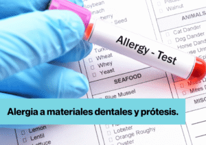 Imagen para la publicación con el texto: " Alergia a materiales dentales y prótesis.", en el fondo aparecen unas manos con unos guantes de laboratorio con un test de sangre y el texto: "Allergy - Test".