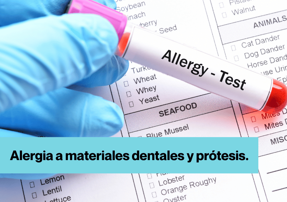 Imagen para la publicación con el texto: " Alergia a materiales dentales y prótesis.", en el fondo aparecen unas manos con unos guantes de laboratorio con un test de sangre y el texto: "Allergy - Test".