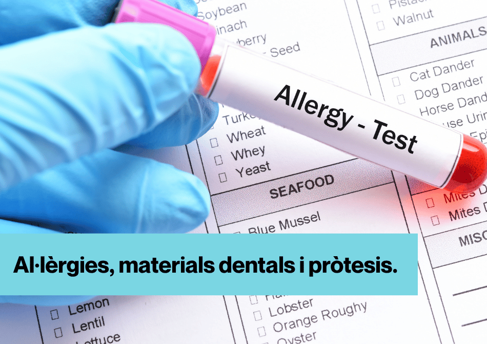 Imatge per la publicació amb el text: Al·lèrgies, materials dentals i pròtesis. Al fons s'aprecia unes mans amb guants blaus de laboratori amb una mostra de sang que posa amb angles: "Allergy - Test"